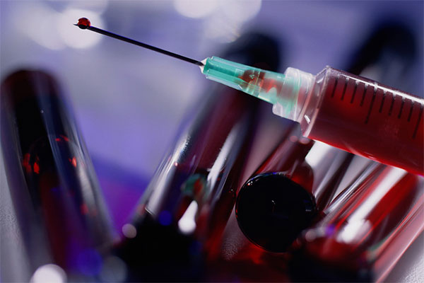 AIDS benzeri esrarengiz hastalık AIDS benzeri esrarengiz hastalık
