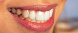 Diş kusurları özgüven kaybına neden oluyor