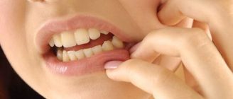Diş gıcırdatma hastalığı